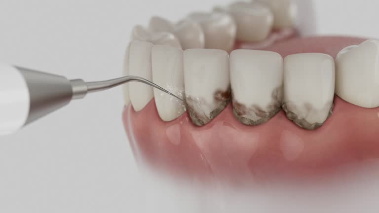 Trusted Teeth Cleaning And Checkup service in Azle, TX - Dentist Open Now